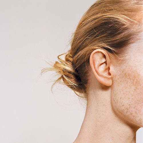 freckled face freckled face